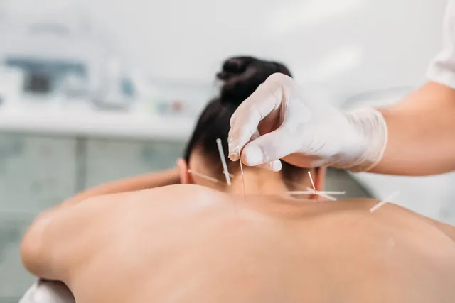 Facial Rejuvenation